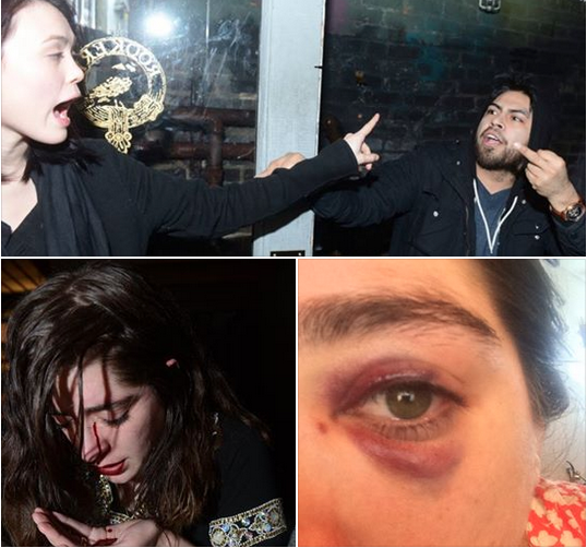 The Host of Boobs of Bushwick Party Got Punched by a Mystery Woman. Help to Identify Her!